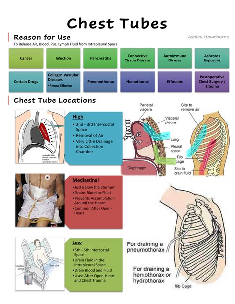 Chest Tubes - Fluid Rises with Inspiration and Falls with Expiration