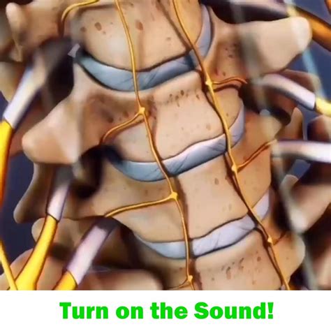 Lumbar degenerative disc disease treatment – Artofit