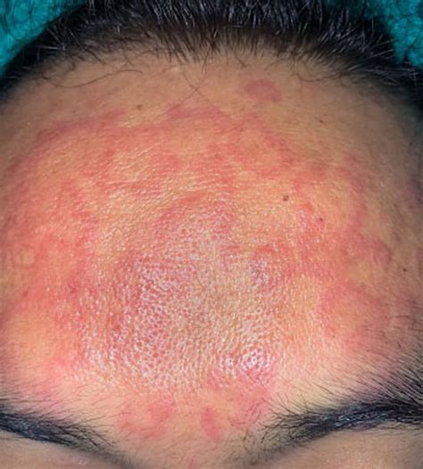 winter park medical dermatology dermatology clinic cosmetic center