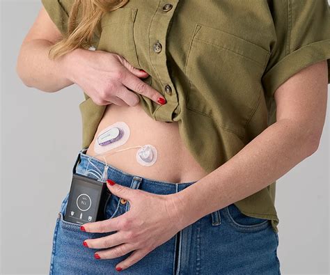 Beta Bionics iLet Bionic Insulin Pump | MyEHCS