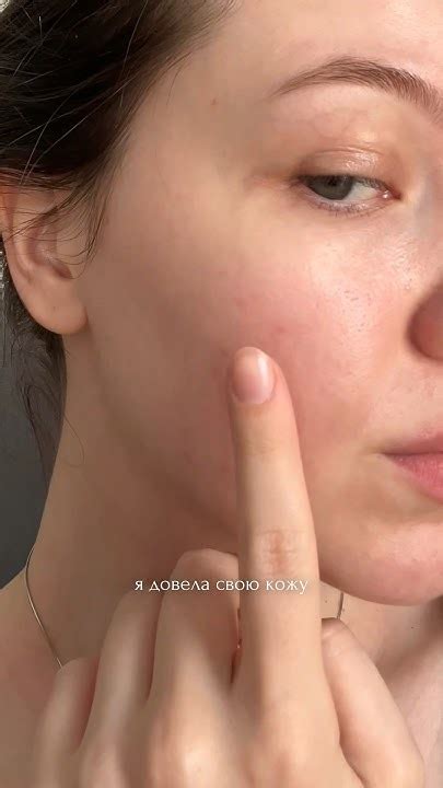 Неидеальная кожа — это нормально 🙂 #бьюти #акне #skincare #уходзакожей ...