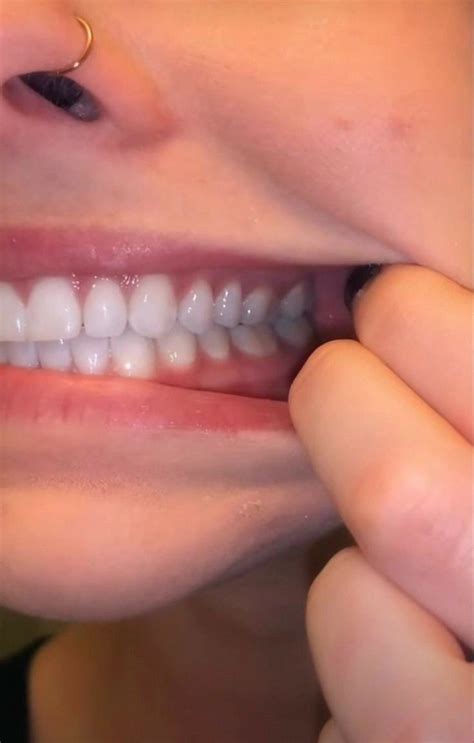 Pin di Demon 😈 su слезы молодой принцессы 🤤😢 | Denti, Bellezza dei ...