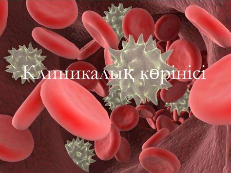 Миелолейкоз. Этиологиясы, патогенезі - online presentation