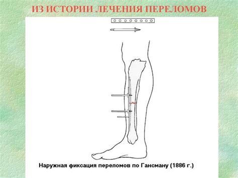 Введение в травматологию и ортопедию - презентация онлайн