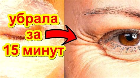 Нависшее Веко Морщины Гусиные Лапки УБРАЛА ЗА 15 МИНУТ Без Пластики ...
