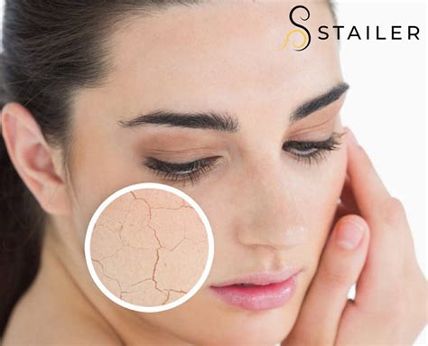 Pielea uscata iti da batai de cap? Cauta remedii la saloanele de beauty ...