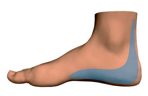 heel pain  beachwood  erie foot  ankle center