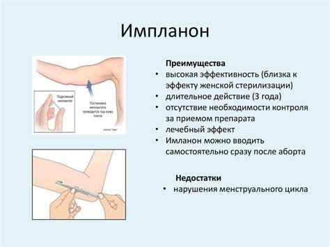 Реабилитация после аборта - презентация онлайн