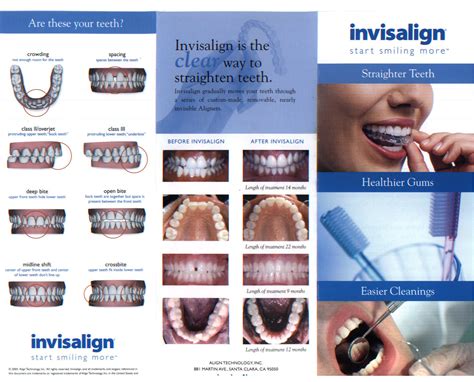 invisalign hornell ny gentle dentist