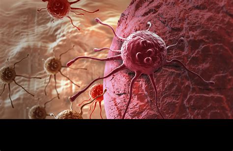 Malignant: Medical Definition, Tumors, and Conditions