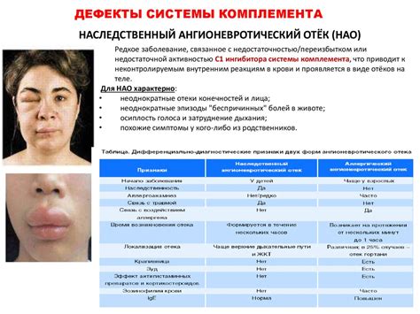 Первичные иммунодефициты. Этиология, патогенез, клинические проявления ...