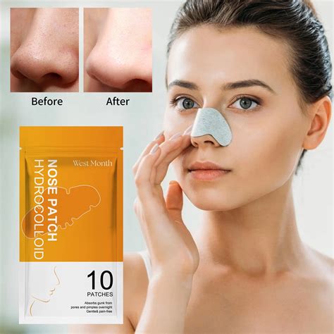 What Dermatologists REALLY Think About Unbelievable Blackhead Removal 2024! Image 11
