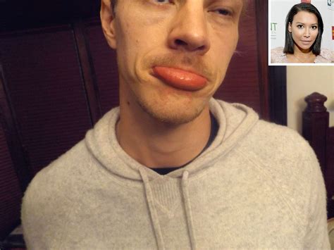 Naya Rivera: Police Release Photos of Ryan Dorsey's Injuries