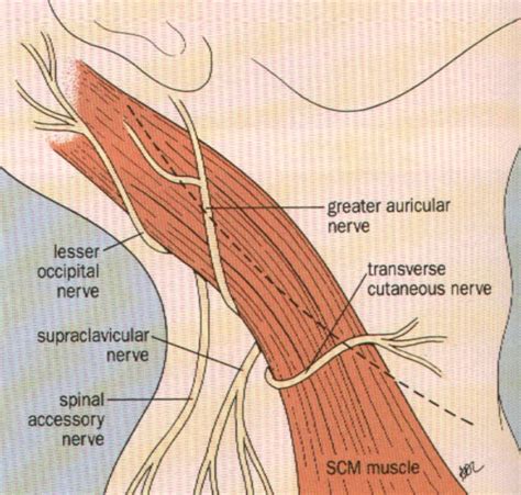 carotid endarterectomy anatomy II Diagram | Quizlet