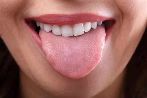 What Does A Healthy Tongue Look Like? Pictures & Issues - Acacia Ridge ...