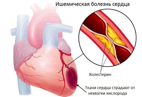 Давление 90 на 60: причины, опасно ли это и что принимать