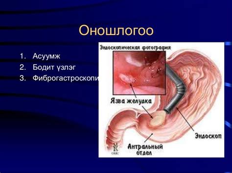 Ходоодны хорт хавдар
