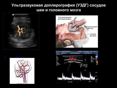 УЗИ сосудов шеи в Москве - сделать ультразвуковое исследование по ...