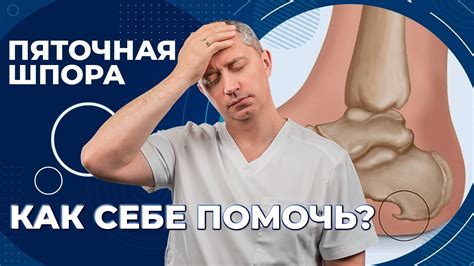 Боль в пятке. Пяточная шпора. Компресс для снятия боли. Как лечить ...
