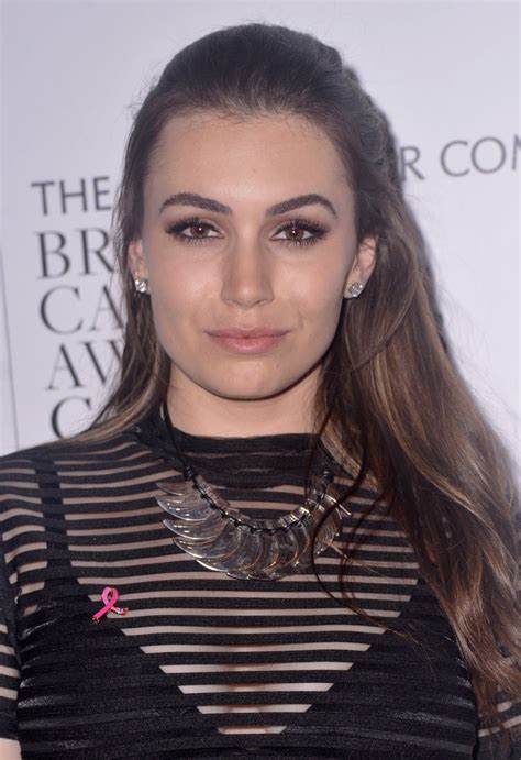 Sophie Simmons Birthmark
