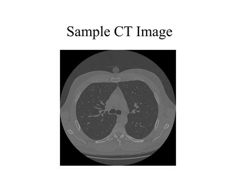 sample ct image powerpoint    id