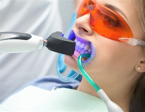 Tooth Whitening, Carntyne Dental Care, Glasgow