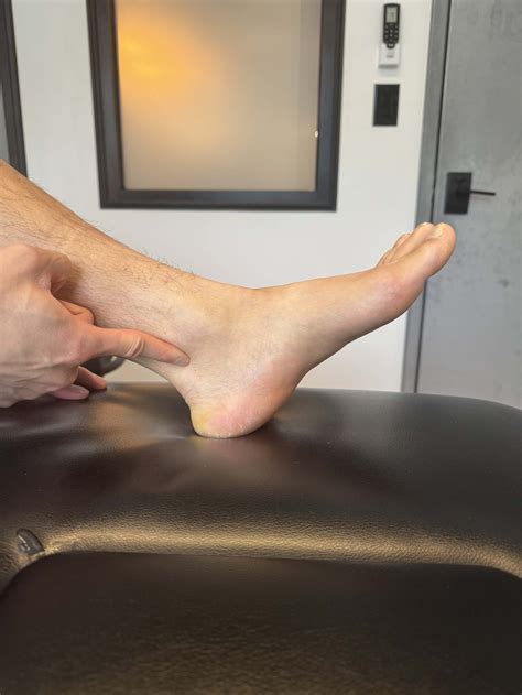 Tib Posterior Tenosynovitis