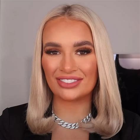 Molly Mae Filler Transformation: Everything You Need To Know