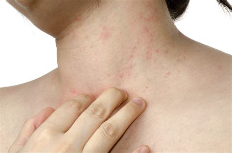 Red itchy spots: Is it time to visit a dermatologist? | Womens Magazine ...