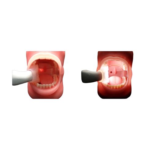 medical onex ebite dentozone corp