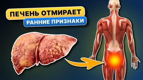 Первые 15 признаков того, что ВАША ПЕЧЕНЬ отмирает! 90% даже не ...