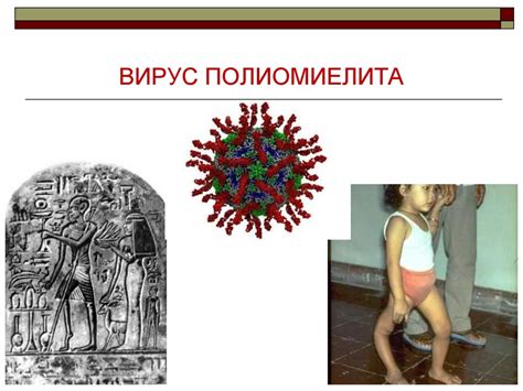 Вирус полиомиелита - презентация онлайн