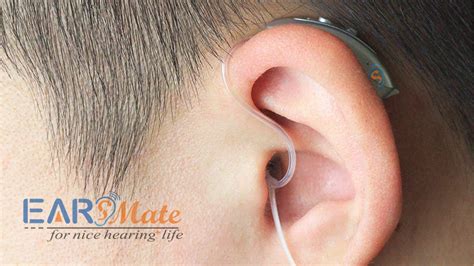 Digital Invisible Bluetooth In Hearing Aids For Iphone And Android - Earsmate