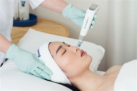 Microneedling Before and After Photos | DermapenWorld