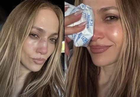 Así quedo el rostro de Jennifer Lopez tras sufrir un accidente y