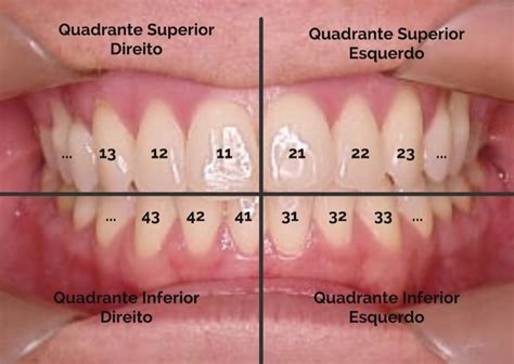 Nome Do Dente Da Frente - 10