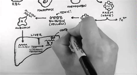 Bilirubin 1 - Bilirubin Pathway - YouTube