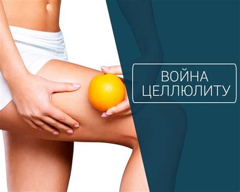 Что такое целлюлит и как с ним бороться
