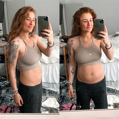 C-section Scar Progress (1st & 2nd) – Move With Truelove