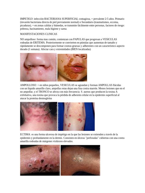 impetigo  especialidades medicas piel