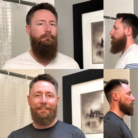 Shocking Beard Transformations