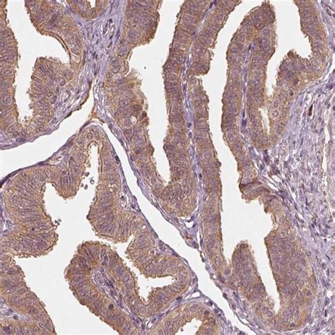 RPS5 Antibody (PA5-66442)