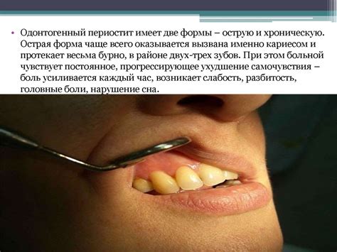 Одонтогенные воспалительные заболевания челюстно-лицевой области ...