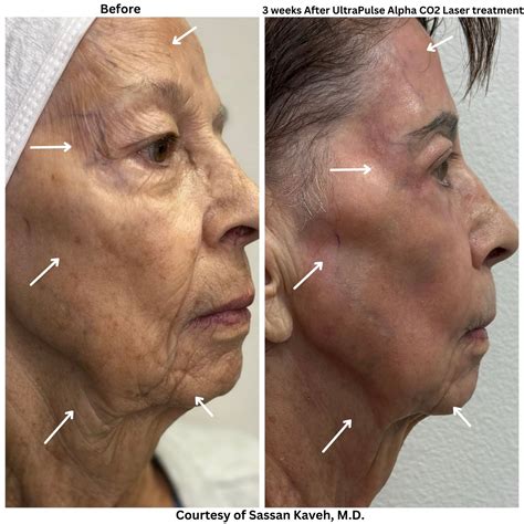 Alpha Medical Aesthetics - Medical Spa - Las Vegas, NV