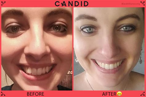 The forum candid io Transformation: Before & After Photos! - 4agat0v