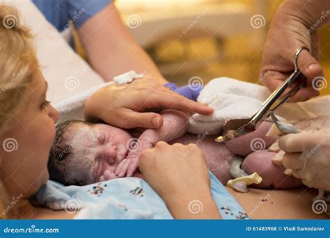 Cordao Umbilical Recem Nascido - Corte Do Cabo De Cordão Umbilical Em Um Bebê Recém-nascido Foto de ...