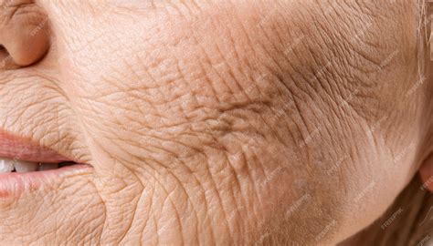 Skin wrinkles and signs of aging featuring details of facial wrinkles