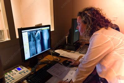 Eos x-ray imaging - Stock Image - C035/4823 - Science Photo Library