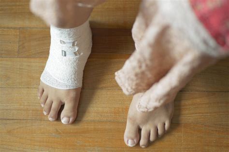 wound care  treatment   feet