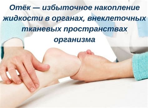 Причины отеков и как вывести лишнюю воду - Красота и здоровье ...